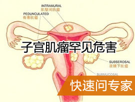 子宫肌瘤危害咨询